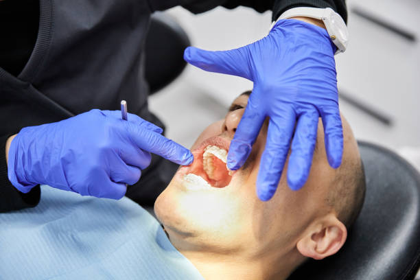 Best Emergency Tooth Extraction in Hamilton College, NY